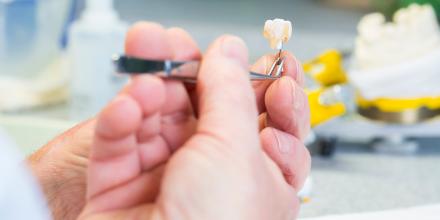 Zahntechniker hält mit einer Pinzette eine künstliche Zahnkrone in der Hand. Im Hintergrund sind unscharf Laborutensilien und Werkzeuge zu sehen.